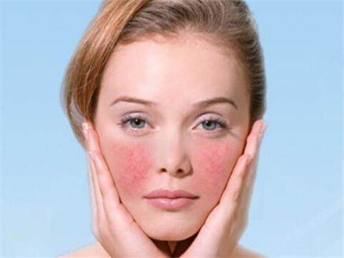 红血丝快速祛除小妙招,如何清除红血丝小窍门