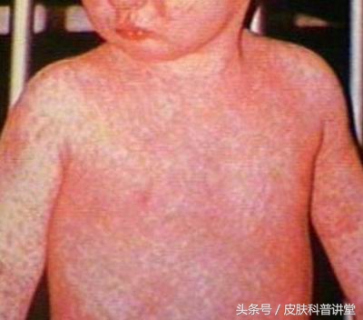 皮肤科普健康知识讲座,皮肤科普视频