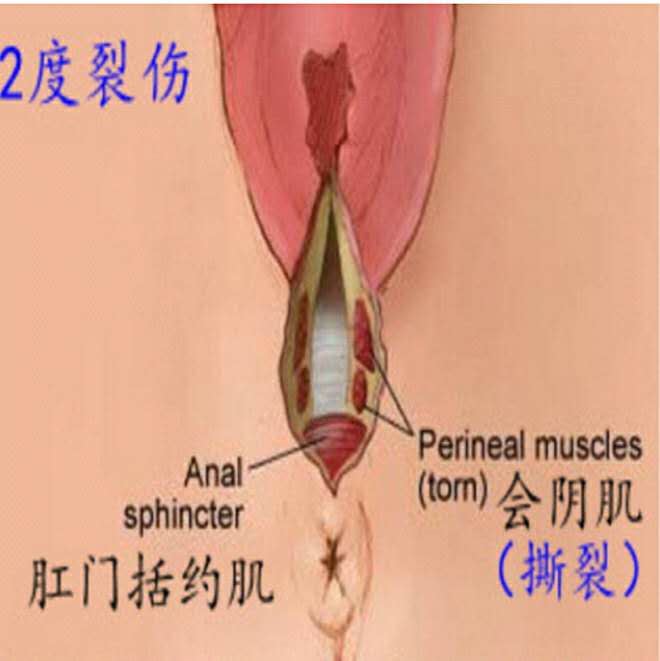 女子警报器响起,女生拉响警报器