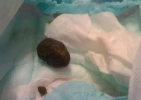 关于宝宝大便的11种性状,宝宝大便6种形状