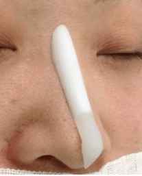 有多少人隆鼻后悔了,隆鼻的十大猫腻