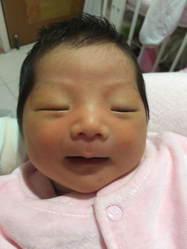 abo溶血性黄疸严重的话需要换血吗,新生儿黄疸400换血后会有什么反应