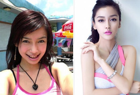 医美整形关于鼻子的知识,怎么分辨整形的鼻子