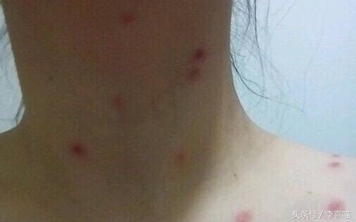 如果猫咪得了猫癣该怎么办,总有人问猫咪生病怎么回答