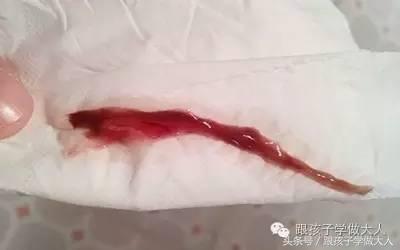 孕妈妈每周做一次b超,准妈妈孕期需要做哪些检查