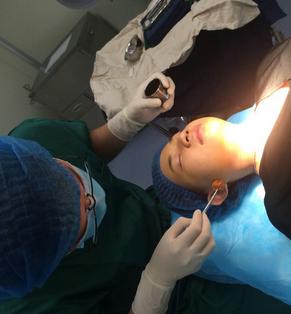 韩式三点双眼皮恢复单眼皮,韩式三点式双眼皮是永久性的吗