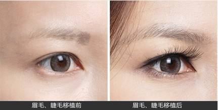 种植睫毛的技巧和方法,种植睫毛太浓怎么办