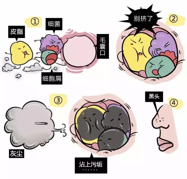 angelababy痘痘,angelababy额头冒巨痘