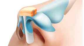 怎么按摩可缩小鼻头,鼻头肥大怎么按摩变小