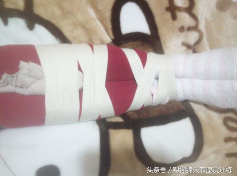 怎么纠正宝宝o型腿,o型腿矫正神器哪种好