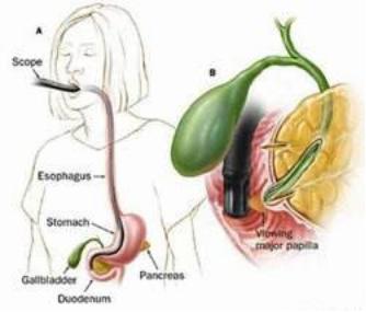 发生重大医疗事故的真实案例,传染病重大医疗事故真实案例