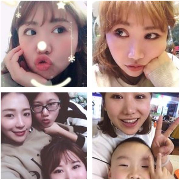 全切双眼皮会不会显老,全切双眼皮显老可以修复年轻吗