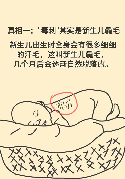 猪毛风在医学上叫什么病,新生儿的猪毛风是什么