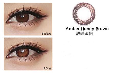 隐形眼镜藏在眼球半年,怎样检查隐形眼镜是否藏在眼球后