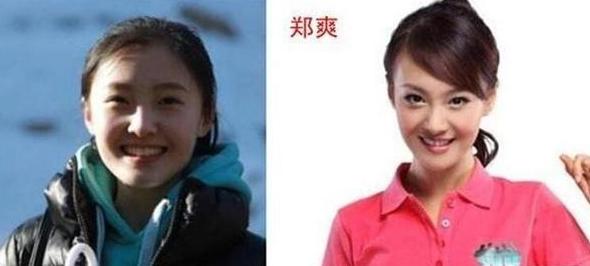 艺考撞脸明星,艺考学生整容