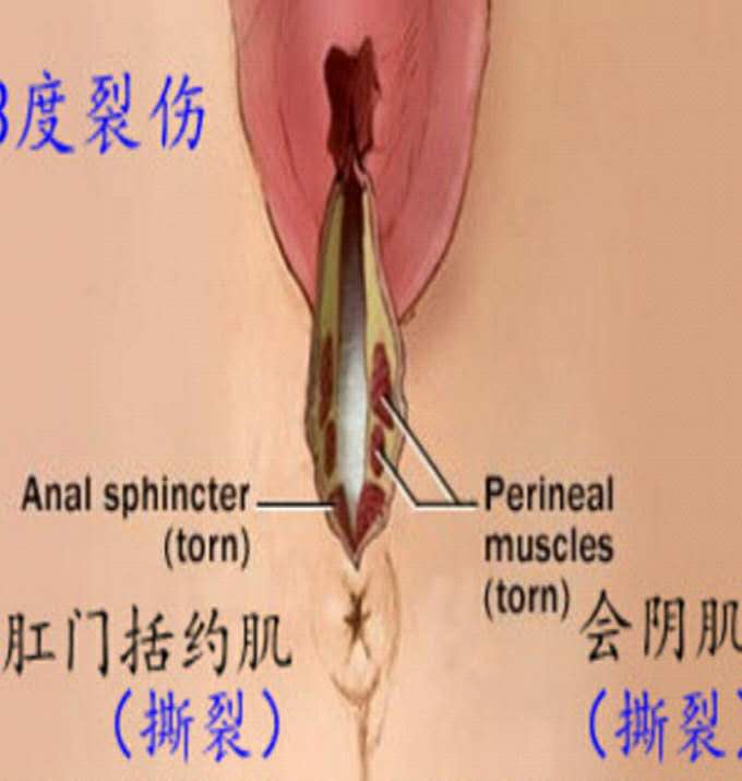 女子警报器响起,女生拉响警报器