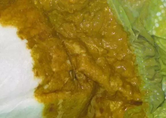 关于宝宝大便的11种性状,宝宝大便6种形状