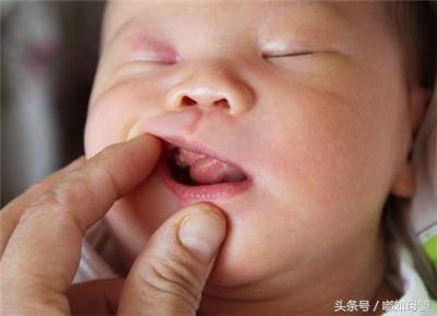 新生儿这四种现象很正常，父母无需过分惊慌