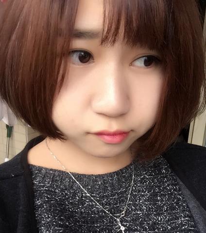 韩式三点双眼皮恢复单眼皮,韩式三点式双眼皮是永久性的吗