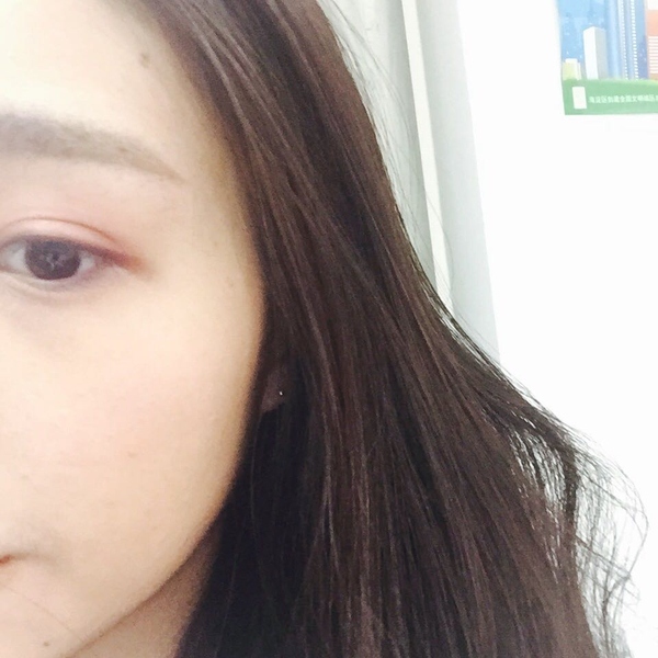 变美还是要祛痘,变美第一步祛痘