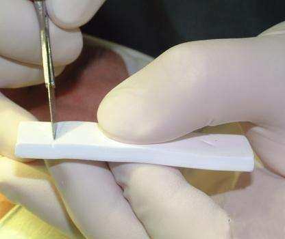 鼻假体用什么材料最好,鼻假体都有什么型