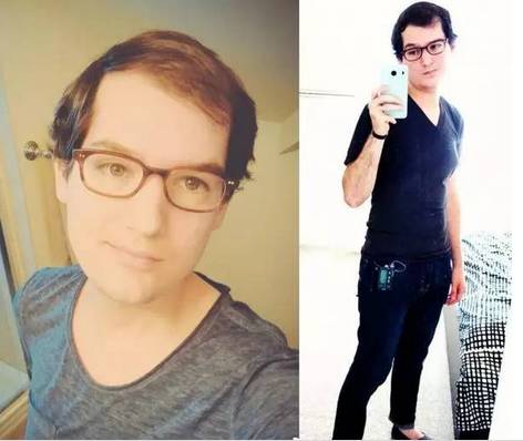 男人服用大量雄性激素会怎么样,男生长期服用雌性激素会怎么样