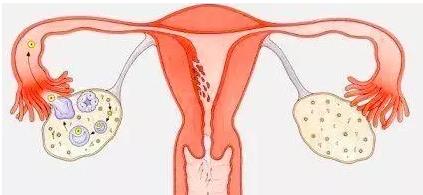 卵巢早衰彩超显示卵巢小怎么调理,子宫卵巢衰老能治吗