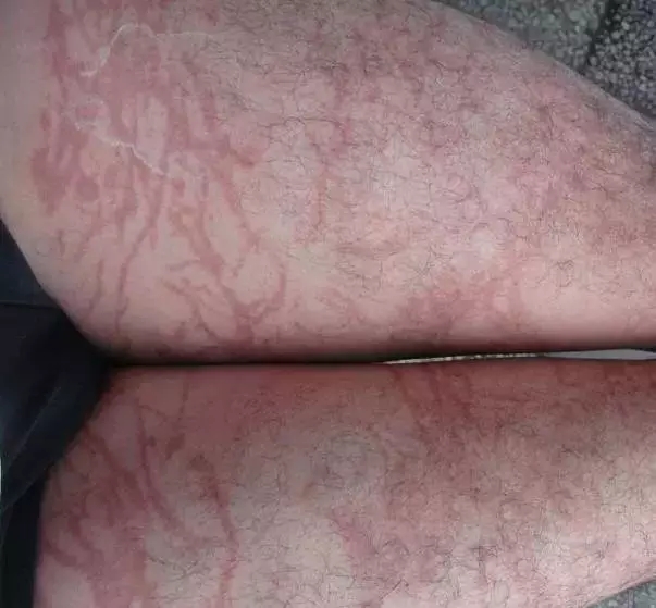 去厦门海滩玩有危险吗,在海边看到什么东西就要赶紧跑