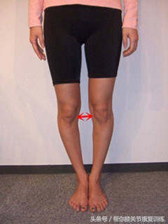 怎么纠正宝宝o型腿,o型腿矫正神器哪种好