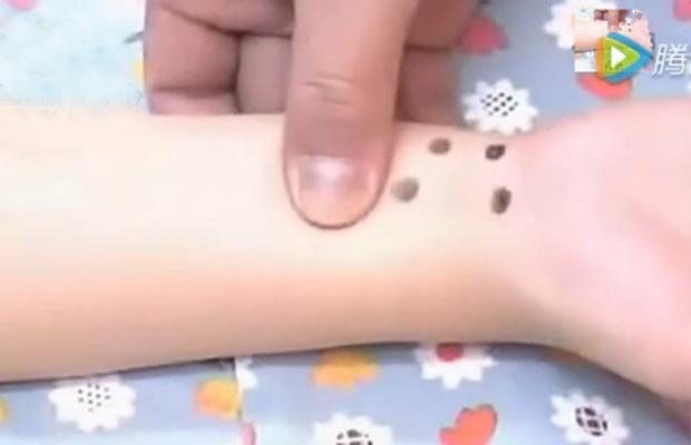 湘西点穴治疗脑瘫的名医,小儿脑瘫推拿疗法