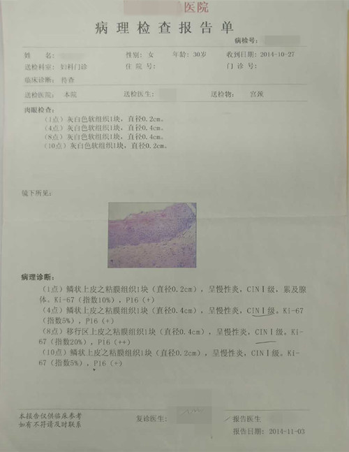 宫颈疾病方面病例分析,临床诊断宫颈病变怎么治疗