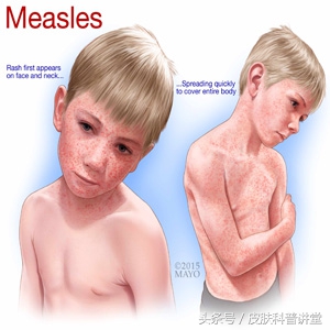 皮肤科普健康知识讲座,皮肤科普视频