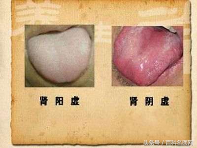 你是阳虚还是阴虚一文告诉你,你是肾阴虚还是肾阳虚