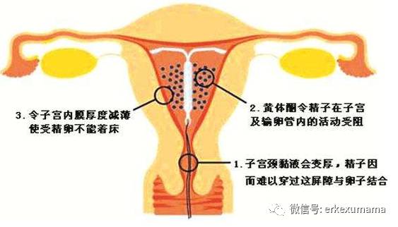 课堂笔记：哺乳期避孕，那些方法不伤害你和宝宝！
