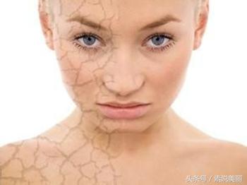 脸到春天就起皮是咋回事,春天手起皮怎么治疗