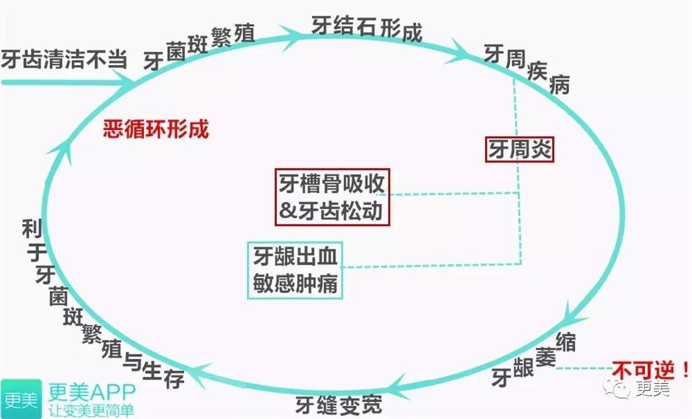 洗牙后牙缝变大松动错位,洗牙后牙齿松动的的亲身经历