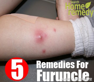 疖病科普文章,疖与疖病