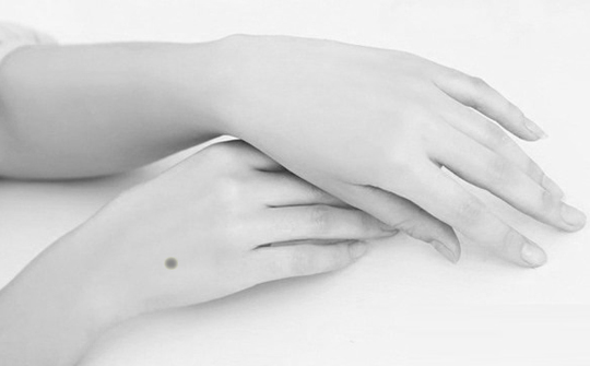 手上长黑痣表示身体哪里不好,皮肤黑斑结痂很厚是否皮肤癌