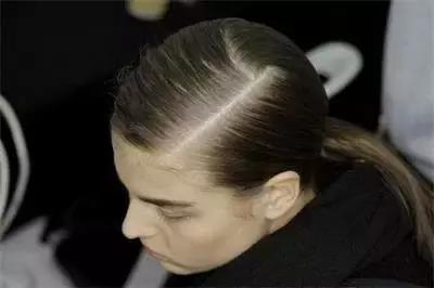 中药调理地中海有效果吗,中医治疗地中海贫血完整药方