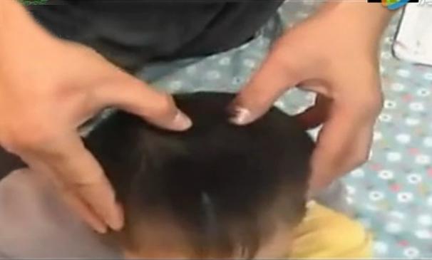 湘西点穴治疗脑瘫的名医,小儿脑瘫推拿疗法