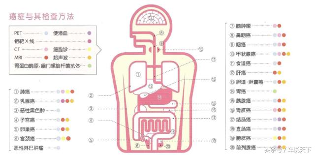 日本最好的早癌医院,日本癌症早期筛查旅游