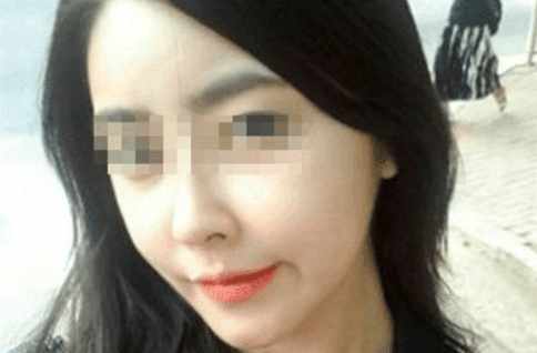 鼻假体用什么材料最好,鼻假体都有什么型