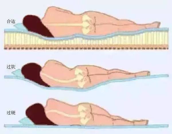 腰椎间盘突出你不了解的四件事,腰椎间盘突出这四点一定要注意