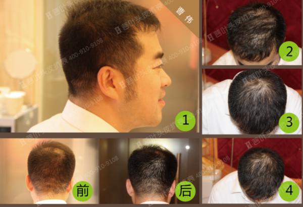 这些头发养护的误区你中过几个,这些脱发知识你一定要知道