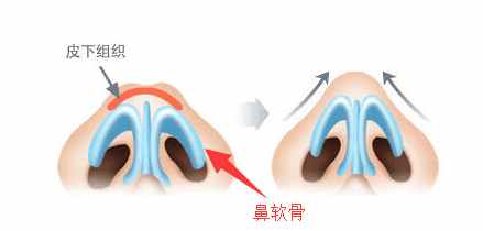 怎么按摩可缩小鼻头,鼻头肥大怎么按摩变小