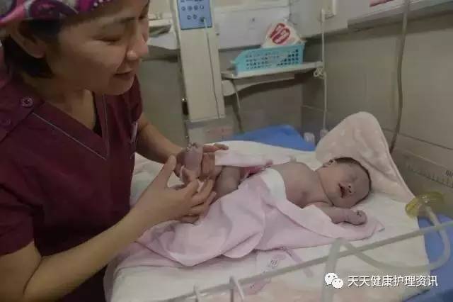 新生儿羊水吸入轻度窒息,新生儿羊水吸入肺怎么回事