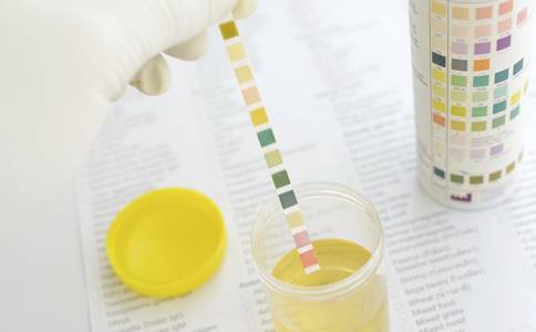 「健康」尿常规报告上这几个指标,告诉你肾好不好!