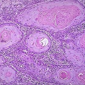 宫颈癌筛查书,宫颈癌筛查报告有几张单子