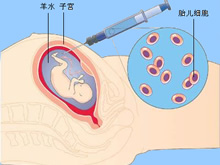 场面震撼！台州20多位医生联手用60袋血击败“死神”救产妇