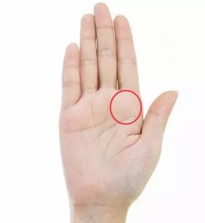 手掌发红用什么药膏,手掌脱皮严重还发红